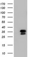 GBE1 Antibody
