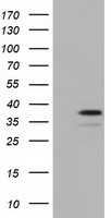 GBE1 Antibody