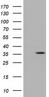 GBE1 Antibody