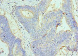 GC Antibody