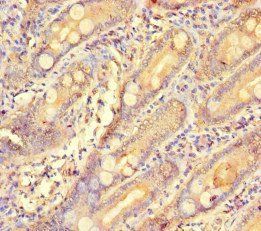 GCHFR Antibody