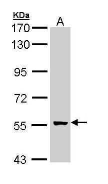 GCM2 Rabbit Polyclonal Antibody