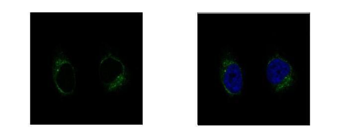 GCP2 Rabbit Polyclonal Antibody