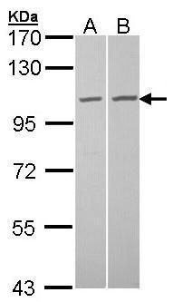 GCP2 Rabbit Polyclonal Antibody