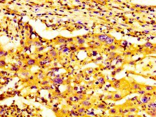GDF7 Antibody