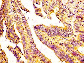 GDF7 Antibody