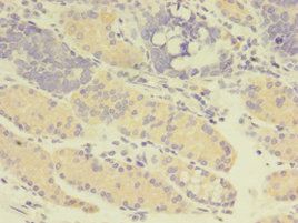 GDI2 Antibody