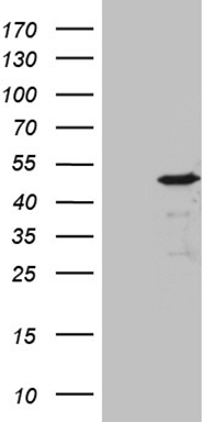 ARHGEF2 Antibody