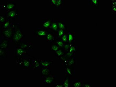 GEMIN2 Antibody