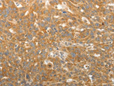 GEMIN2 Antibody