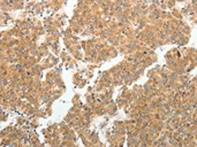 GEMIN2 Antibody