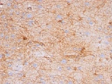 GFAP (Astrocyte & Neural Stem Cell Marker) Antibody