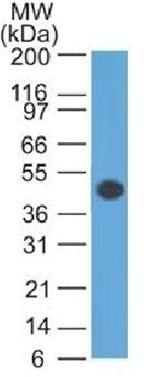 GFAP (Astrocyte & Neural Stem Cell Marker) Antibody