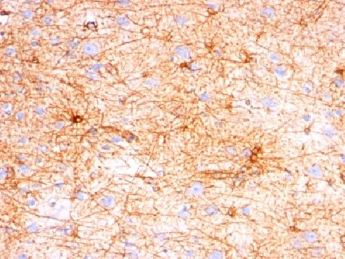 GFAP (Astrocyte & Neural Stem Cell Marker) Antibody