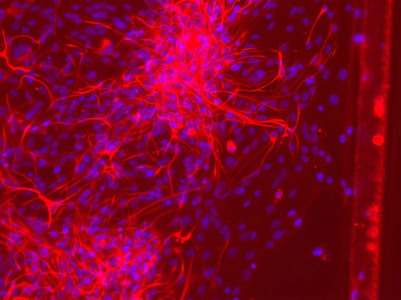 GFAP Antibody