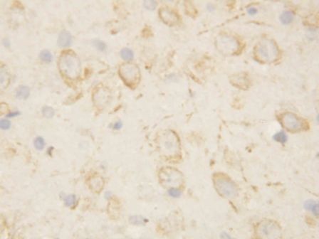 GFAP Antibody
