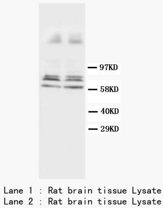 GFAP Antibody