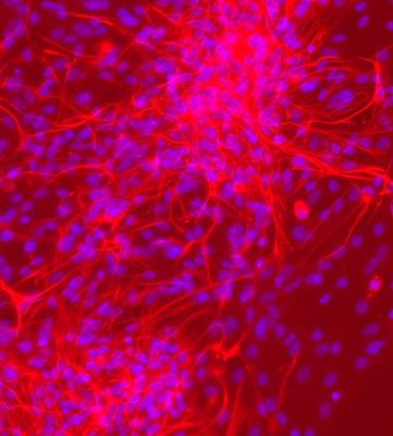GFAP Antibody