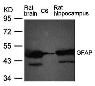 GFAP Antibody