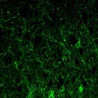 GFAP Antibody
