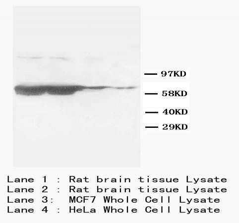 GFAP Antibody (Monoclonal, G-A-5)