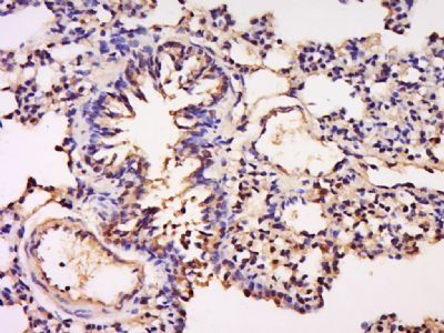 GFI1 Rabbit Polyclonal Antibody