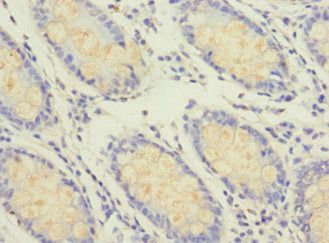 GFM2 Antibody