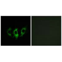 GFM2 Antibody