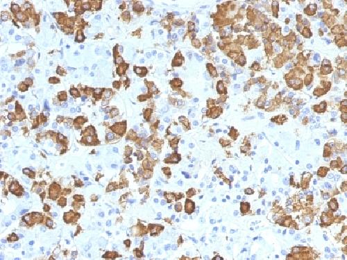 GH1 Antibody
