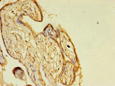 GH2 Antibody