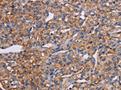 GHITM Antibody