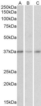 MICS1/GHITM Antibody