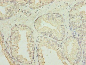 GID8 Antibody