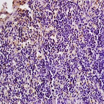 GilZ Rabbit Polyclonal Antibody