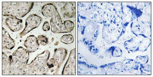 GIMAP5 Antibody