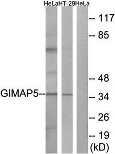GIMAP5 Antibody