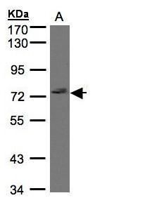 LIMCH1 Rabbit Polyclonal Antibody