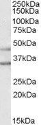 GIRK2/KCNJ6 Antibody
