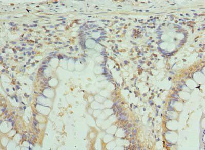 GJA4 Antibody