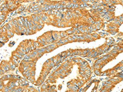 GK Antibody