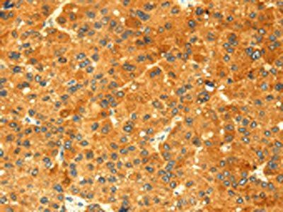 GK Antibody