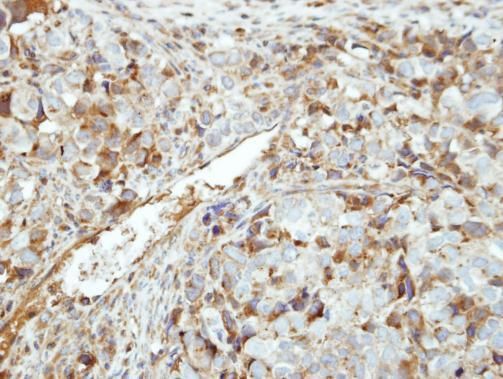 GK5 Rabbit Polyclonal Antibody