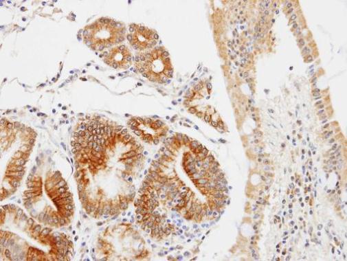 GLOD4 Rabbit Polyclonal Antibody