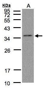 GLOD4 Rabbit Polyclonal Antibody