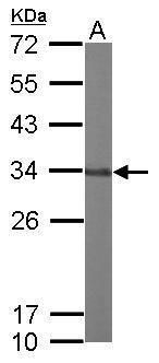 GLOD4 Rabbit Polyclonal Antibody