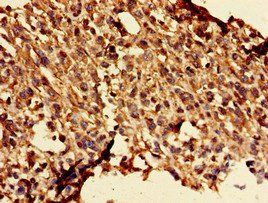GLRA1 Antibody