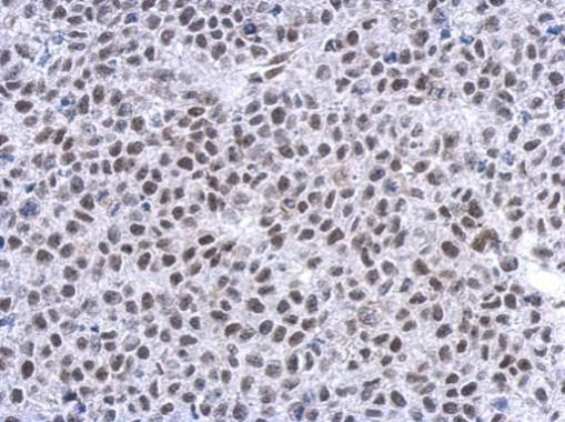 Glucocorticoid Receptor Rabbit Polyclonal Antibody