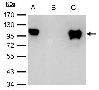 Glucocorticoid Receptor Rabbit Polyclonal Antibody