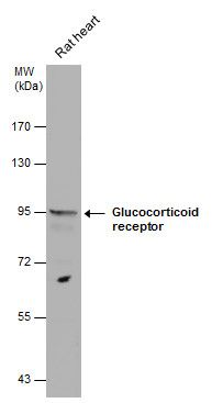 Glucocorticoid Receptor Rabbit Polyclonal Antibody