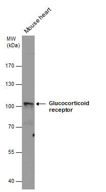 Glucocorticoid Receptor Rabbit Polyclonal Antibody